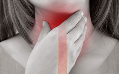 achalasia-5265848
