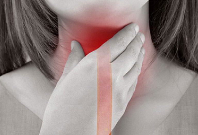 achalasia-5265848