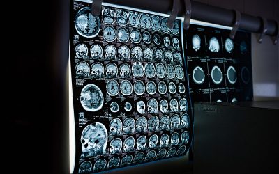 x-ray-g8775942e3_1920