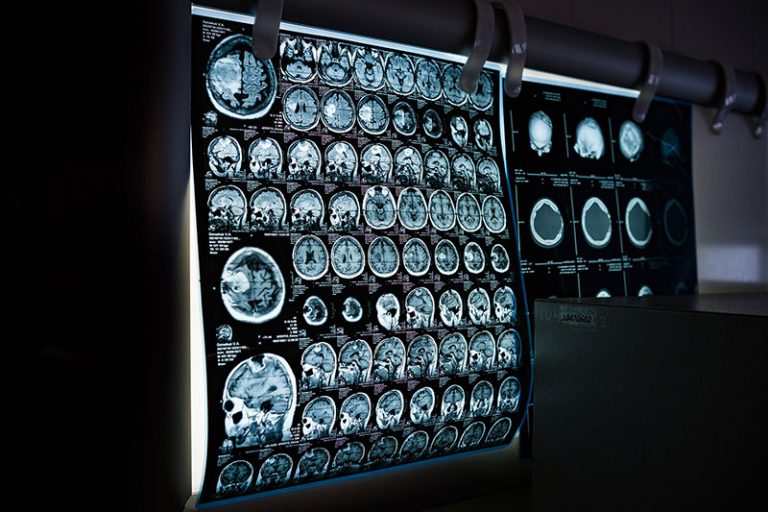 x-ray-g8775942e3_1920