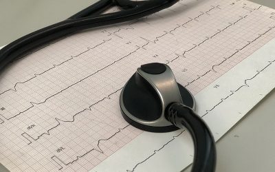 ecg-gb4d6a0294_1920