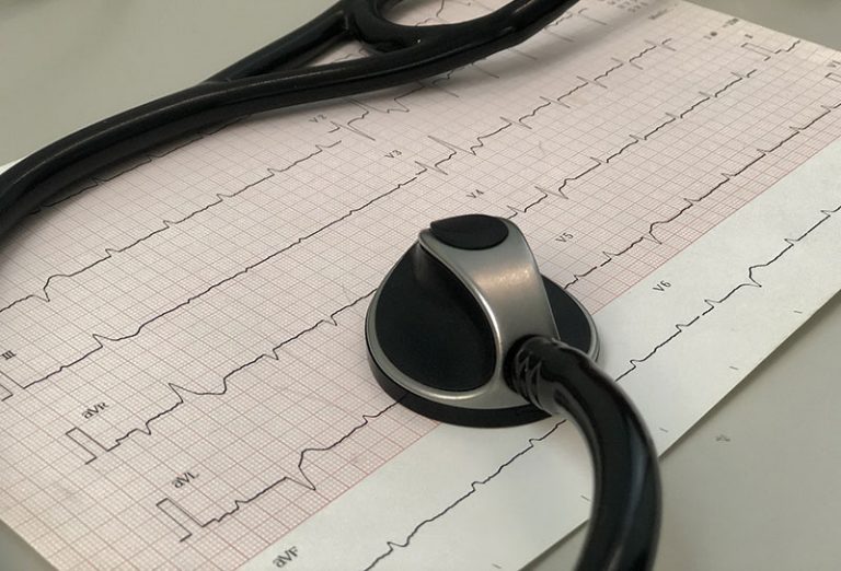 ecg-gb4d6a0294_1920