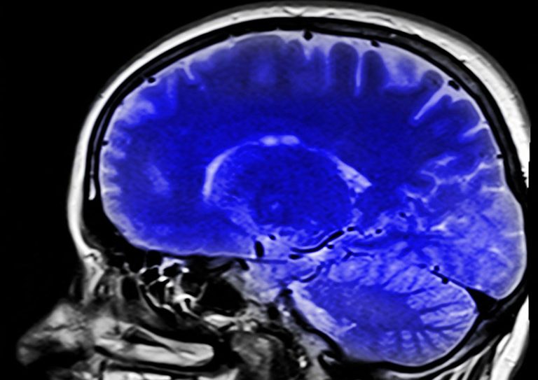 head-254866_1280