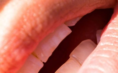 incisors-228998_1920