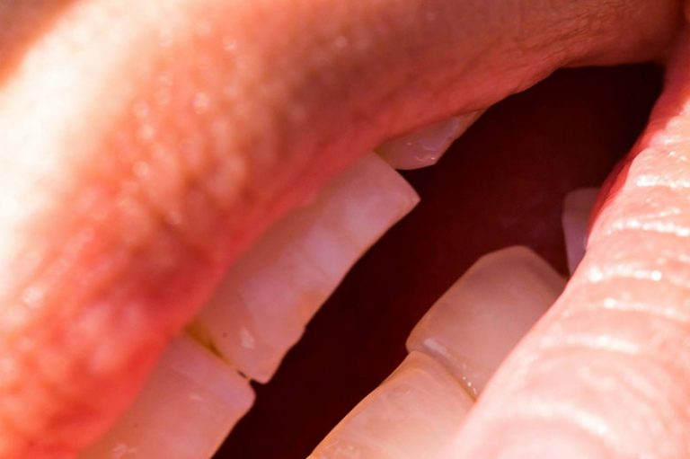 incisors-228998_1920