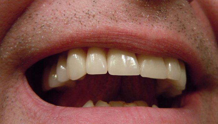 teeth-414489_1280