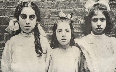 adenoid faces
