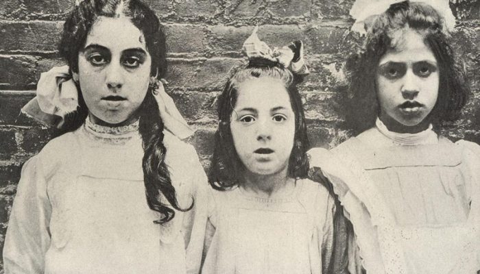 adenoid faces