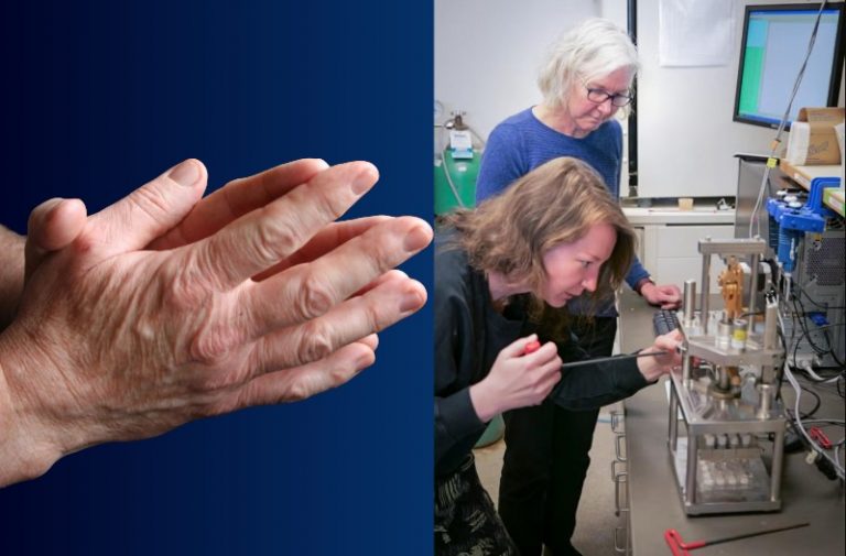 arthritis news